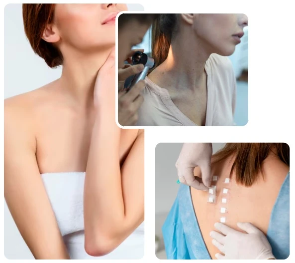 Derma Treatments Img