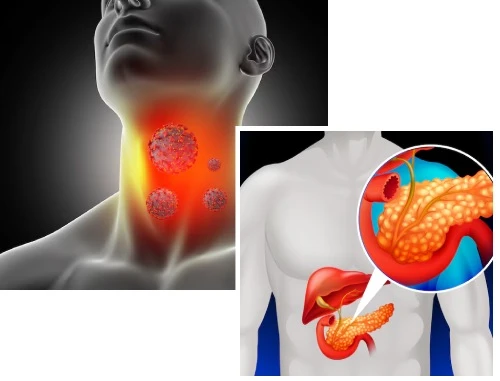 Diagnosis Endocrine Img